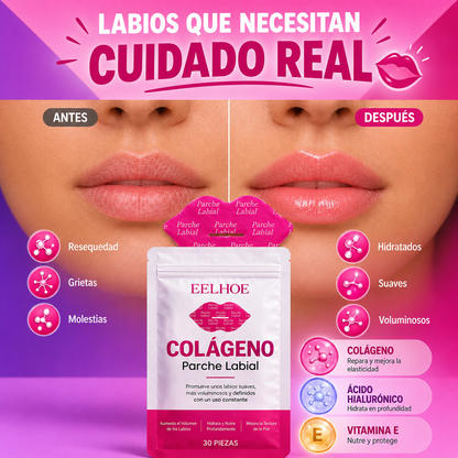 Parches Labiales de Colágeno